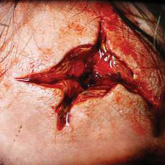 Tinsley 3d fx transfer point black set of two fake wounds, just add a little blood.